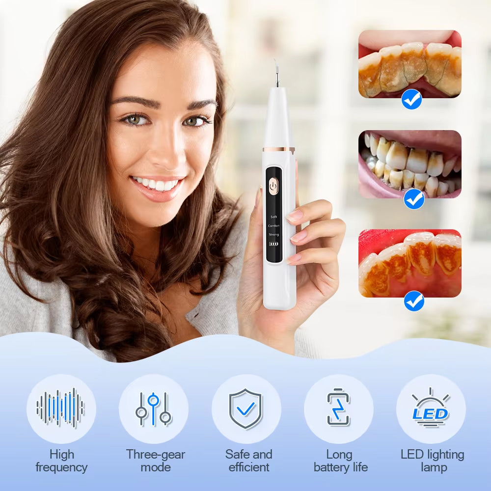DentaEnma High-Frequency Sound Wave Plaque and Tartar Remover