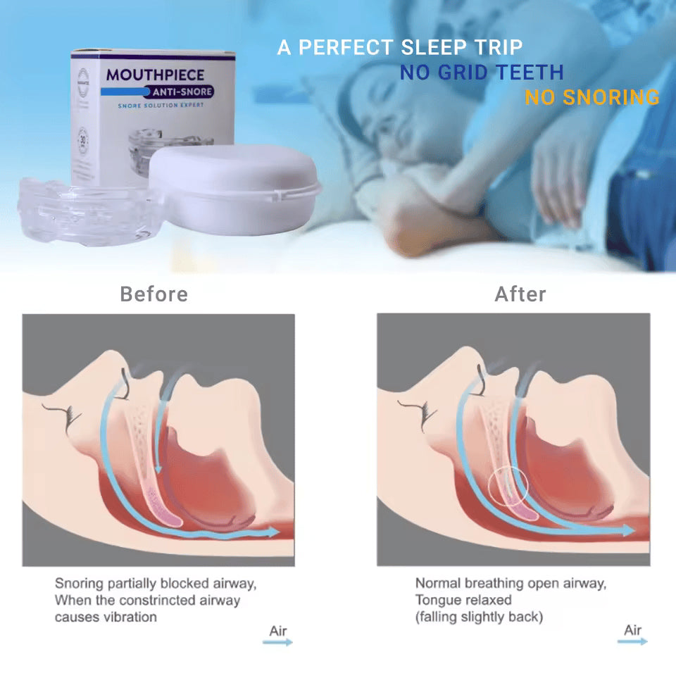 Lullyzee Adjustable Anti-Snore Device UK
