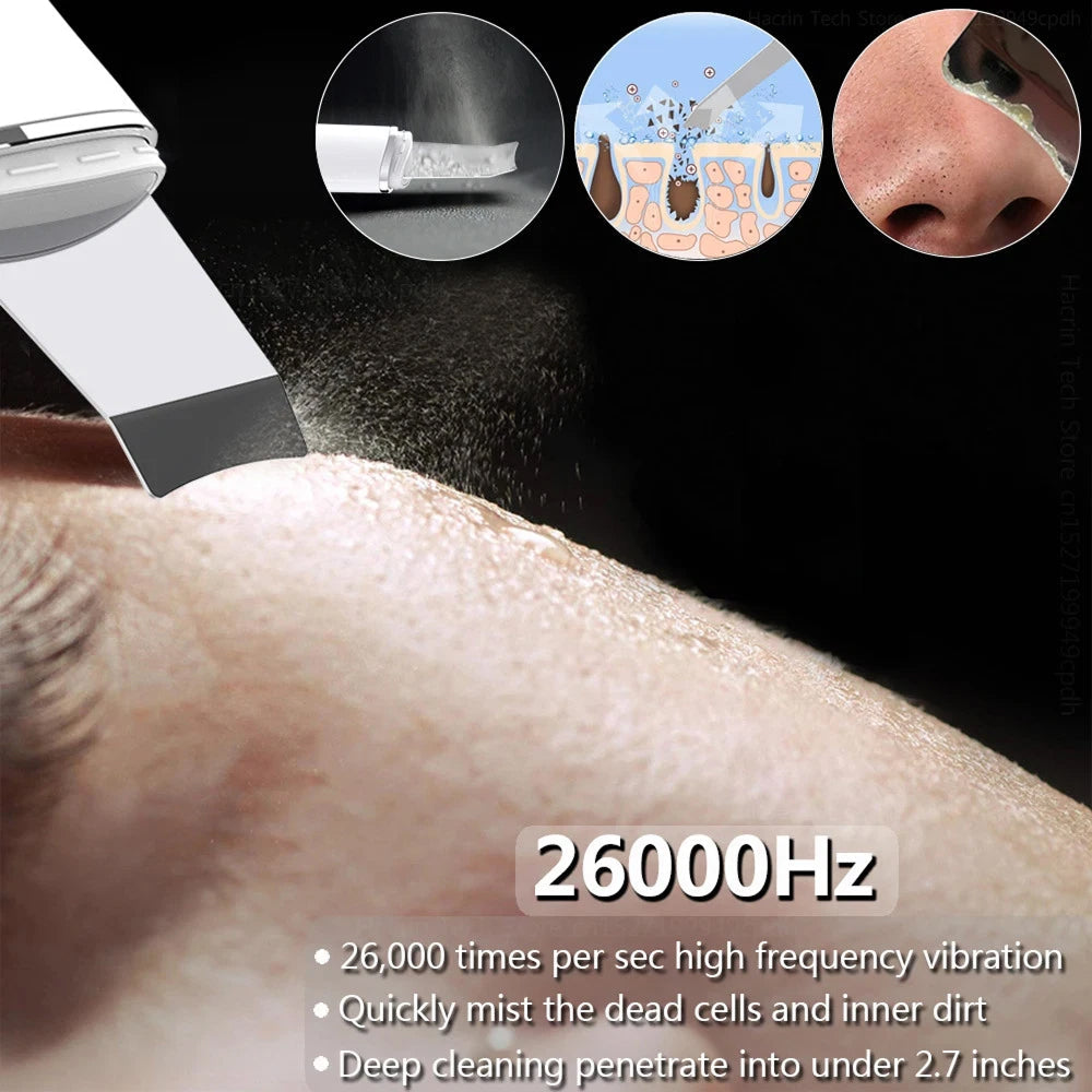 SkinSonyc Ultrasonic Skin Scrubber for Deep Pore Cleansing & Firming