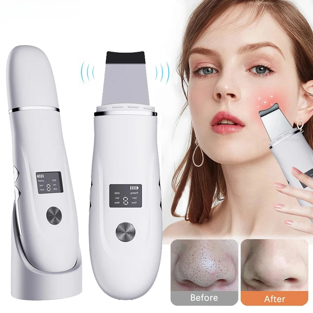 SkinSonyc Ultrasonic Skin Scrubber for Deep Pore Cleansing & Firming