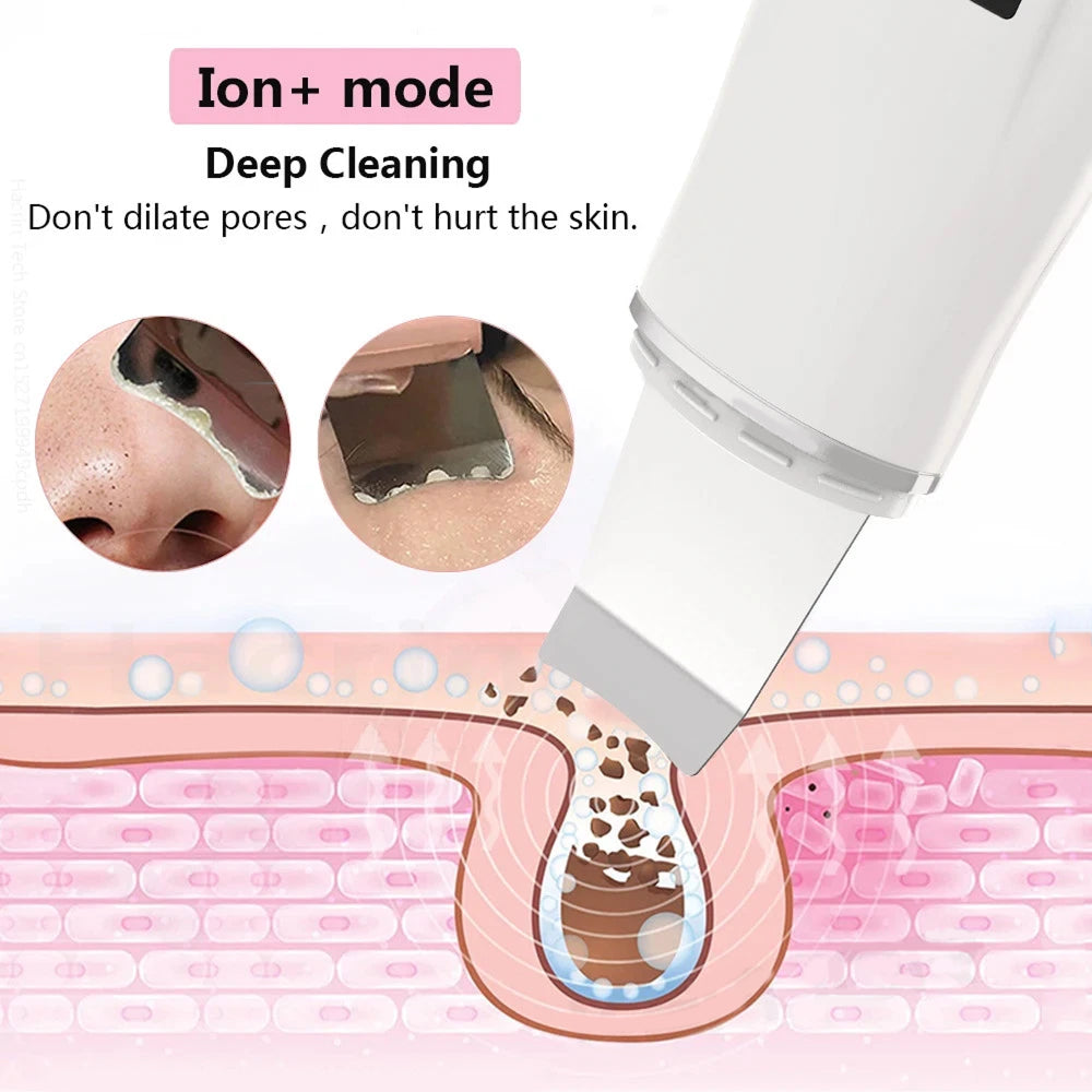 SkinSonyc Ultrasonic Skin Scrubber for Deep Pore Cleansing & Firming