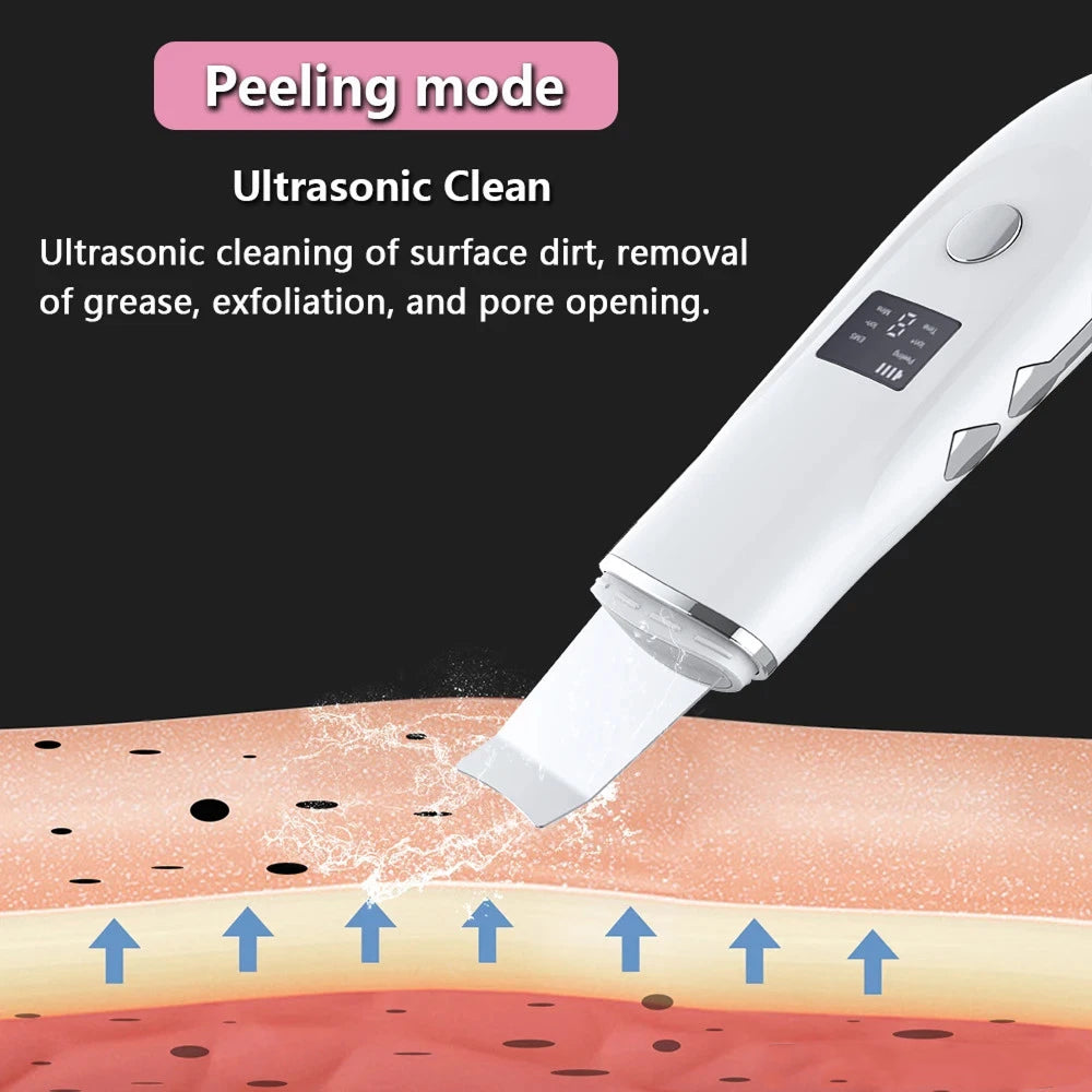 SkinSonyc Ultrasonic Skin Scrubber for Deep Pore Cleansing & Firming