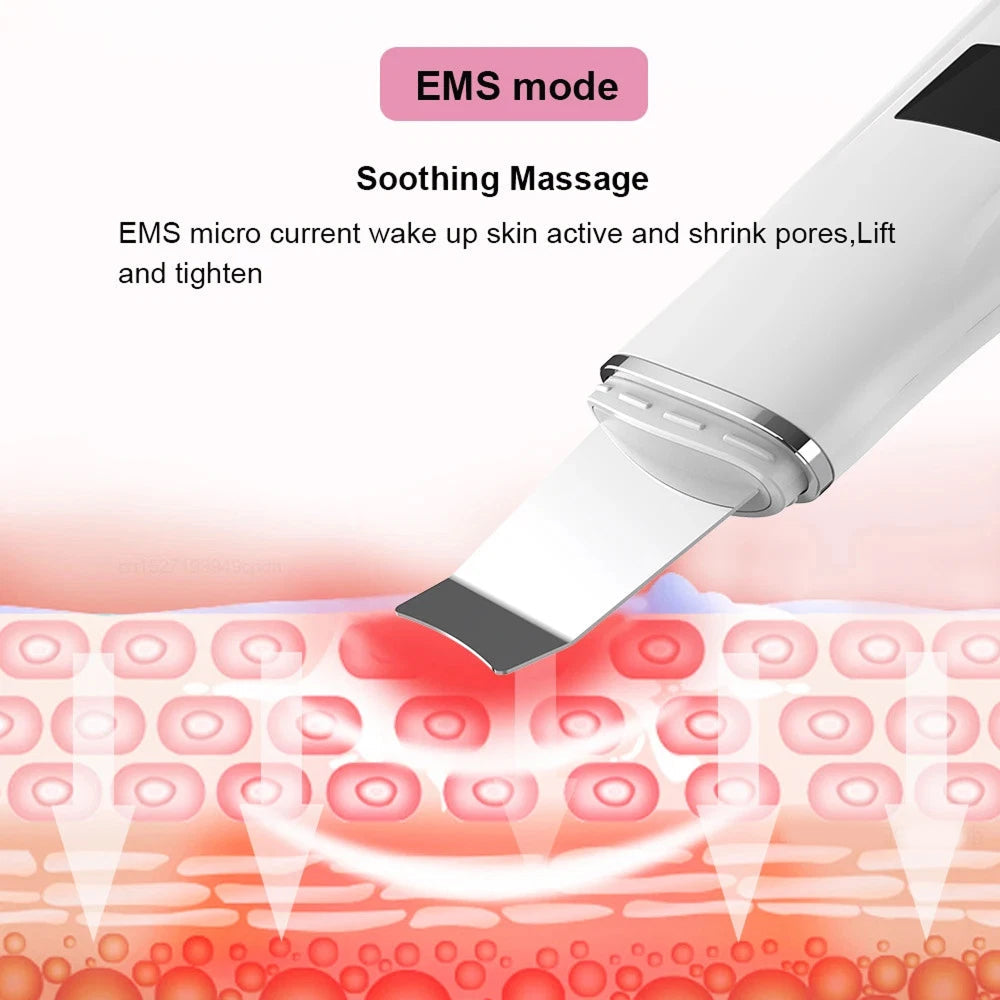 SkinSonyc Ultrasonic Skin Scrubber for Deep Pore Cleansing & Firming